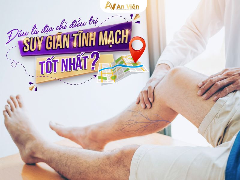 phòng khám giãn tĩnh mạch