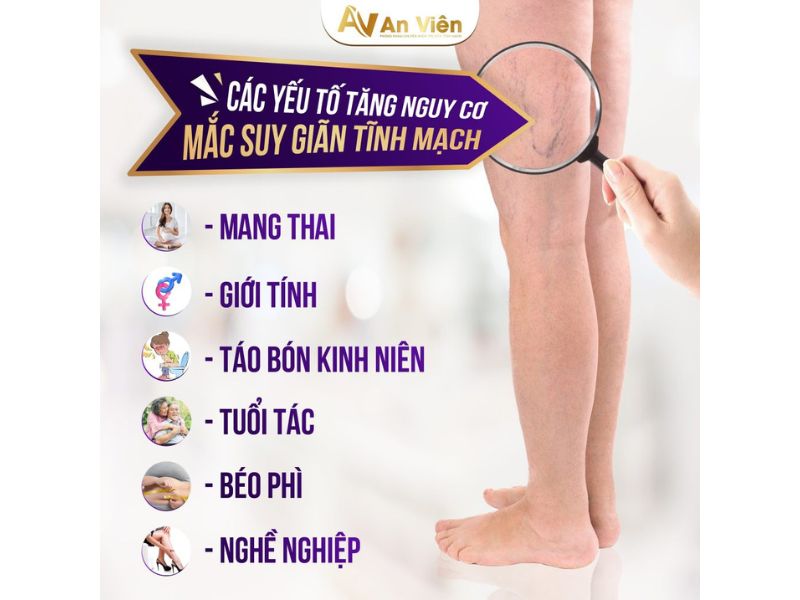 giãn tĩnh mạch và cách điều trị