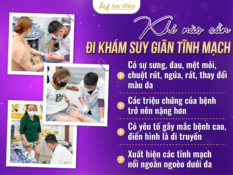 khám giãn tĩnh mạch chân ở đâu