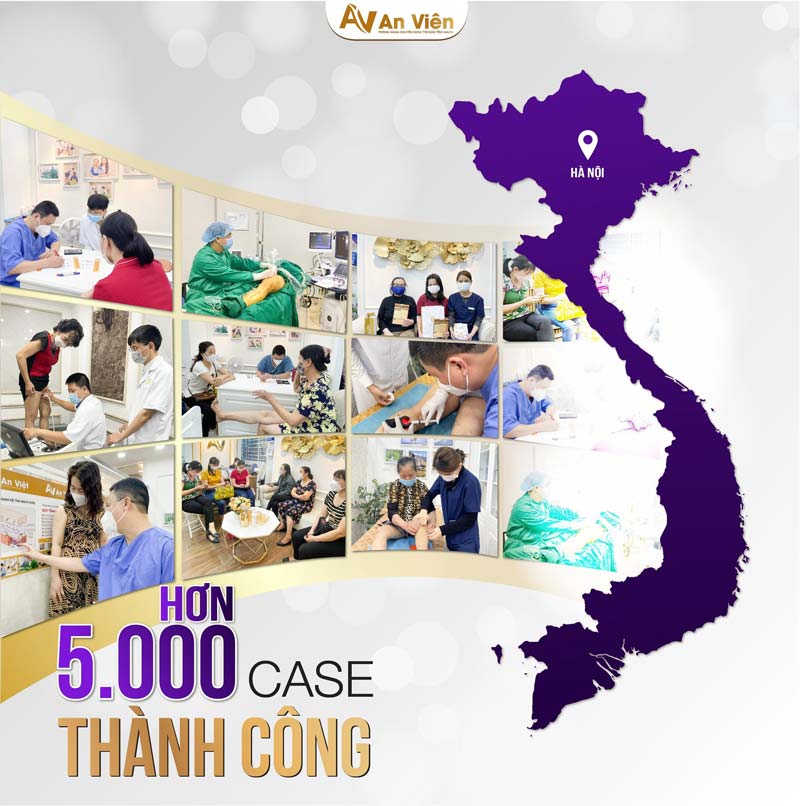 khám giãn tĩnh mạch ở đâu ba