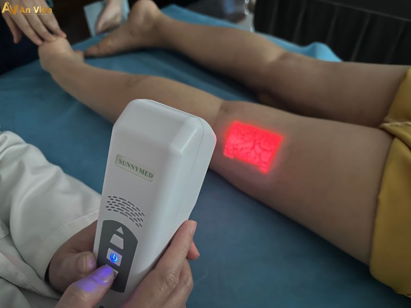 nổi gân xanh ở chân là bệnh gì