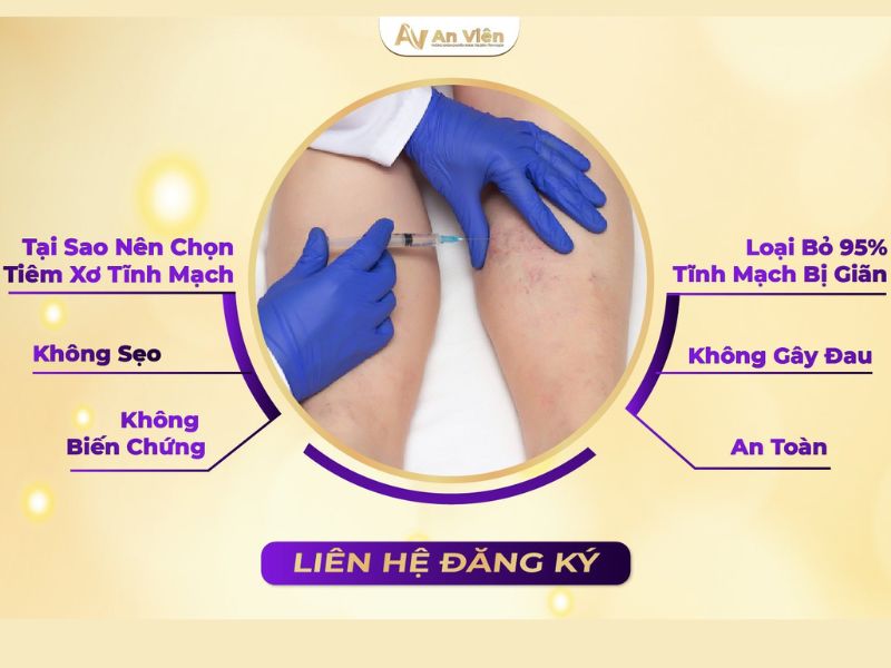 phòng khám tĩnh mạch