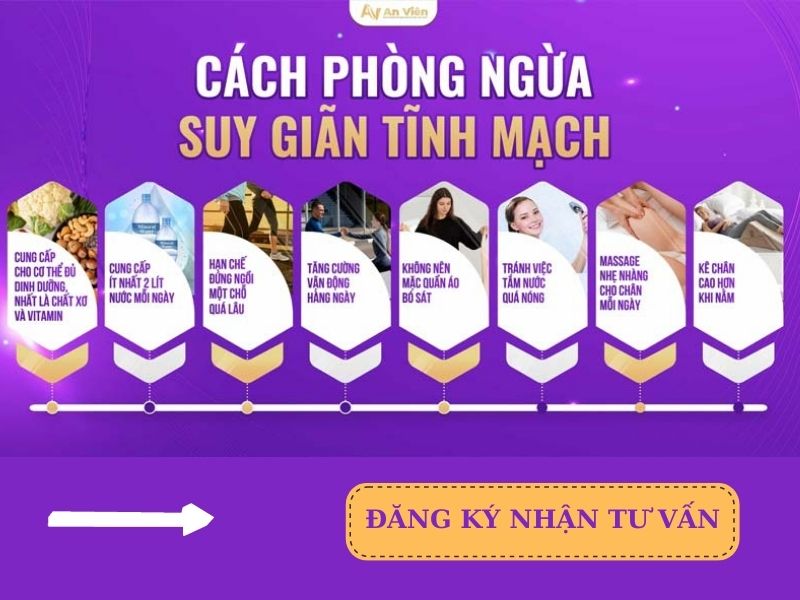 phòng ngừa suy giãn tĩnh mạch ở chân