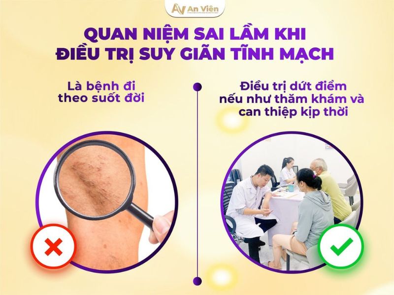 bệnh giãn tĩnh mạch