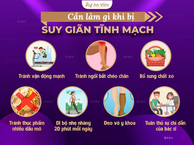bệnh giãn tĩnh mạch