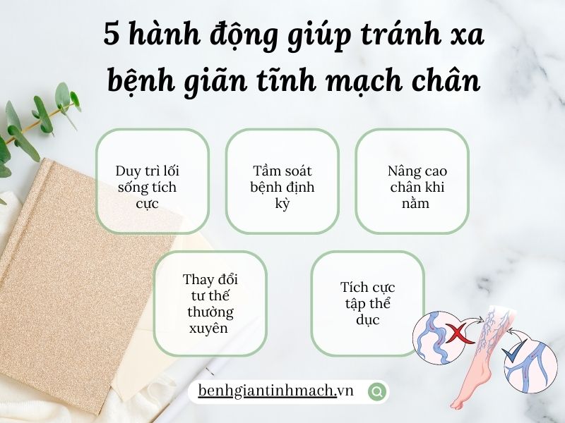 bệnh giãn tĩnh mạch chân
