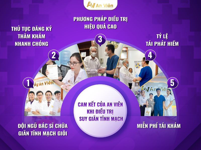 bệnh giãn tĩnh mạch nên khám ở đâu