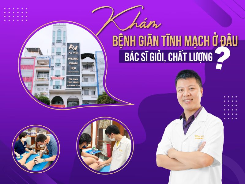 bệnh giãn tĩnh mạch nên khám ở đâu