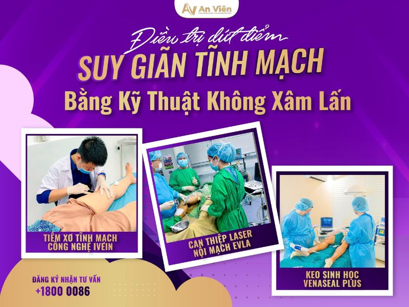 bệnh tĩnh mạch