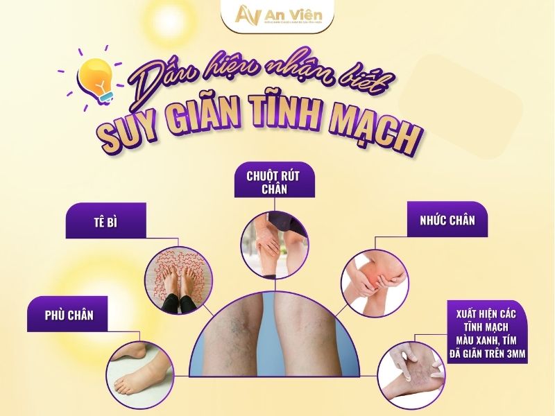 bệnh tĩnh mạch