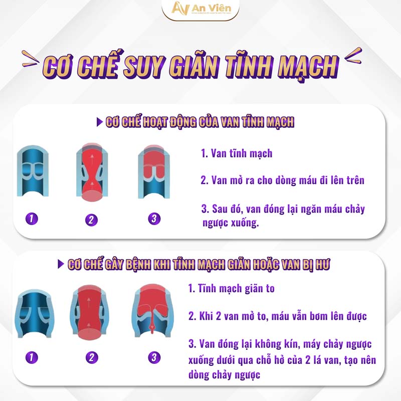 bệnh tĩnh mạch