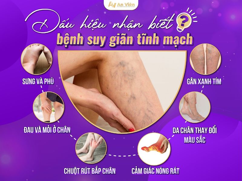 bệnh viện chữa suy giãn tĩnh mạch