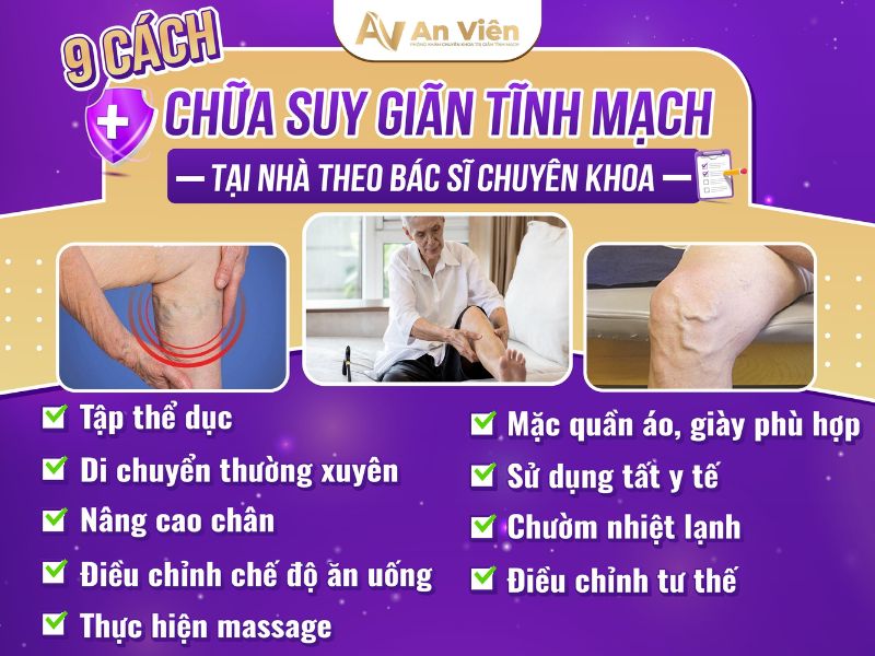 biểu hiện của bệnh giãn tĩnh mạch