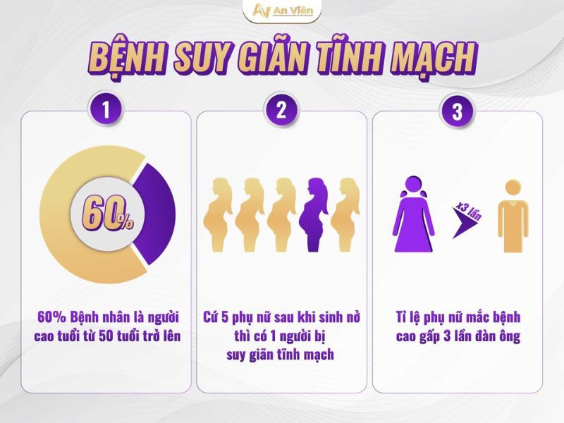 biểu hiện của bệnh giãn tĩnh mạch