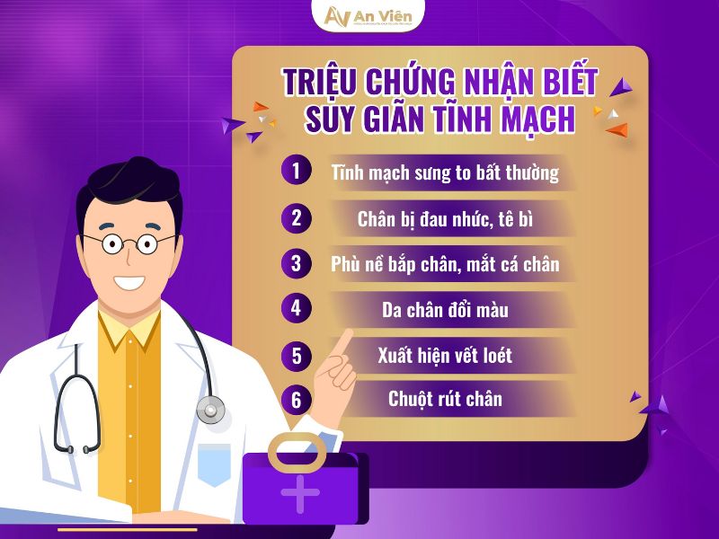 cách chữa giãn tĩnh mạch