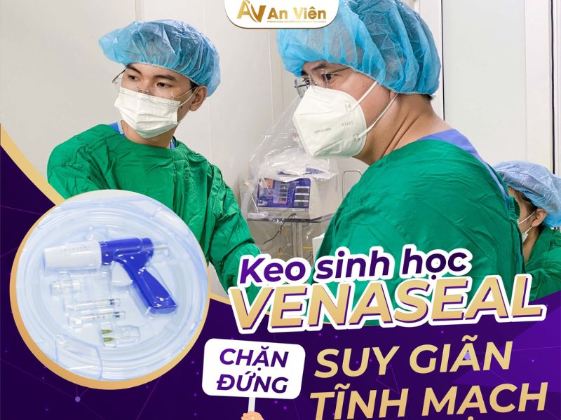 cách chữa giãn tĩnh mạch