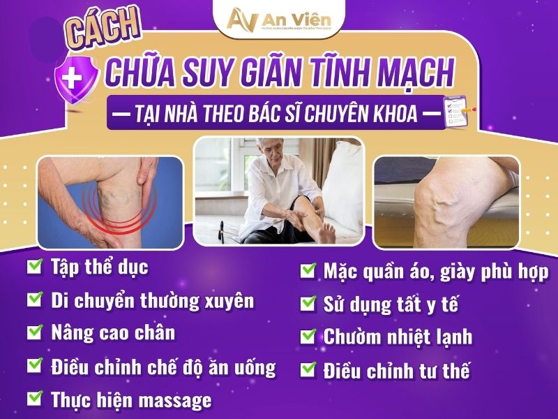 cách chữa suy giãn tĩnh mạch