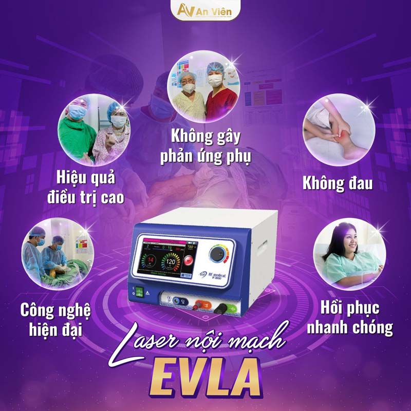 cách chữa suy giãn tĩnh mạch