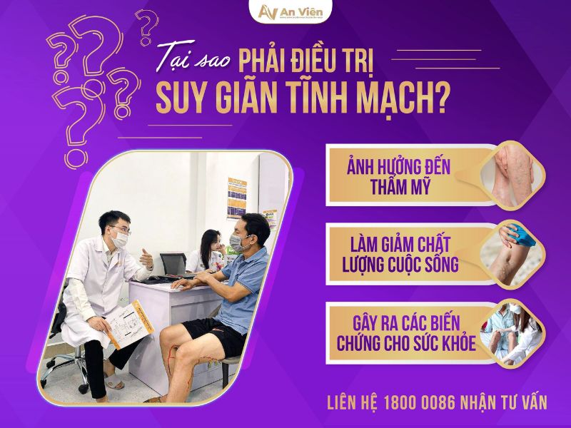 cách điều trị giãn tĩnh mạch