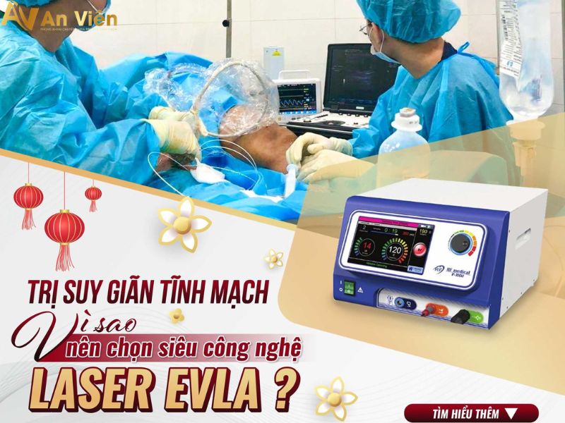 cách điều trị giãn tĩnh mạch