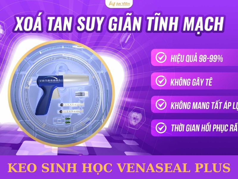 cách điều trị giãn tĩnh mạch