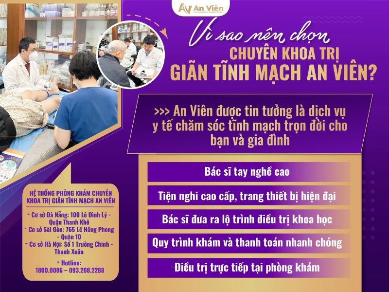 cách điều trị giãn tĩnh mạch