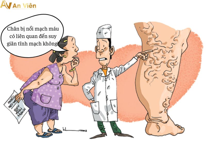 chân bị nổi mạch máu