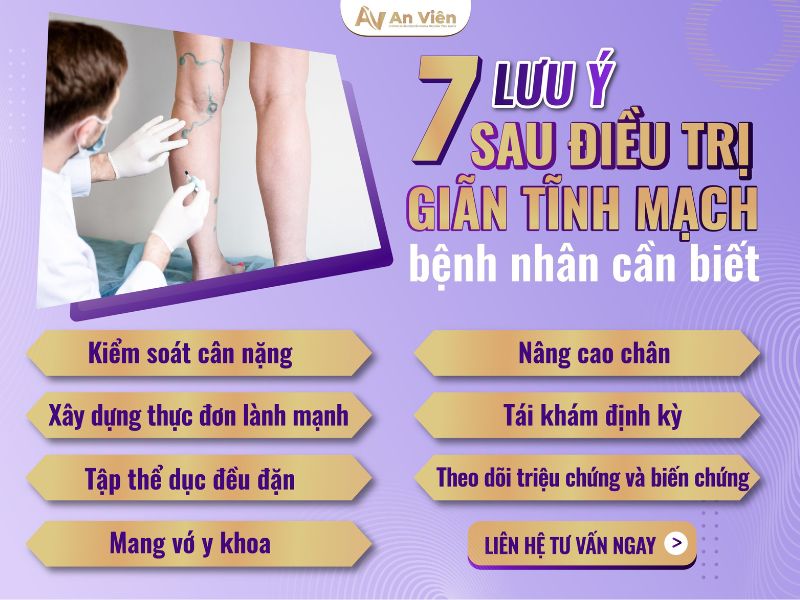 chữa giãn tĩnh mạch chân
