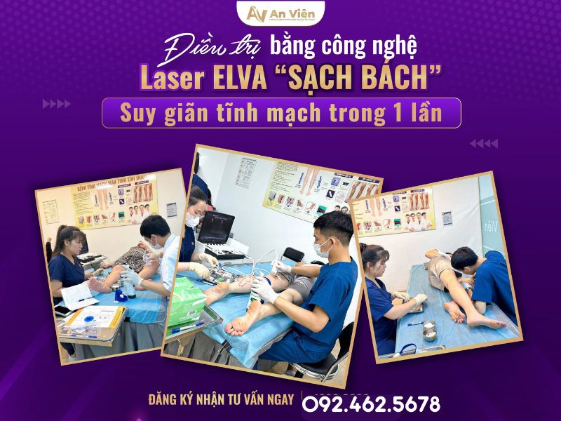 chữa giãn tĩnh mạch chân