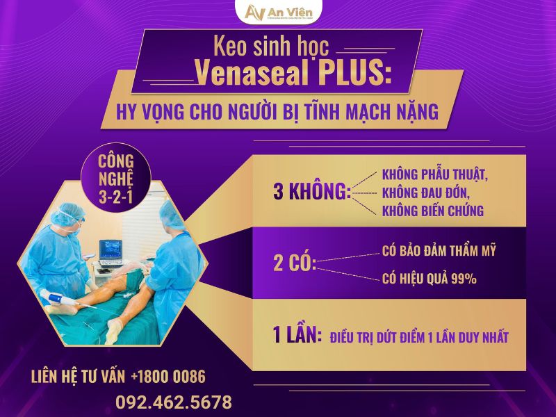chữa giãn tĩnh mạch chân
