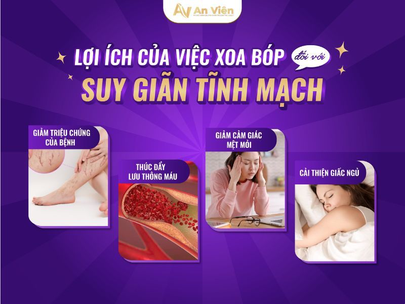 chữa giãn tĩnh mạch tại nhà