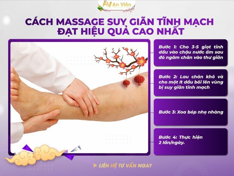 chữa giãn tĩnh mạch tại nhà