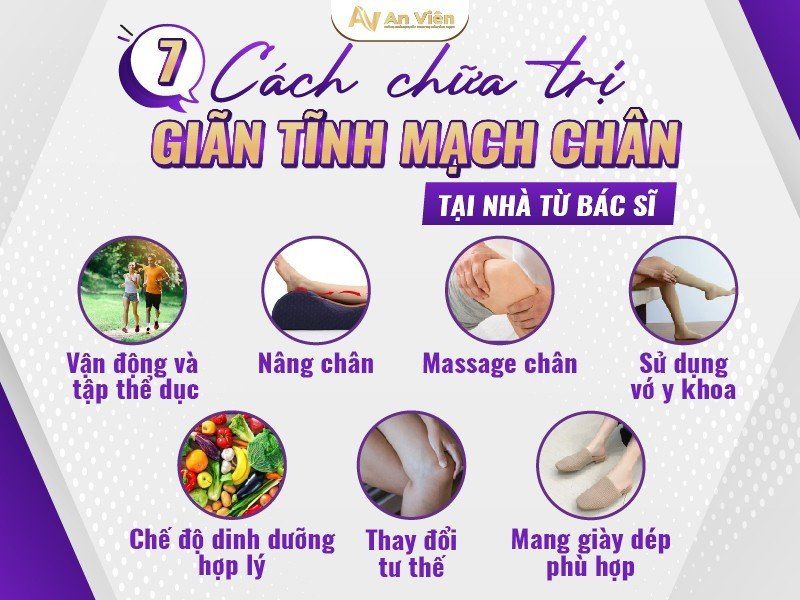 chữa giãn tĩnh mạch tại nhà