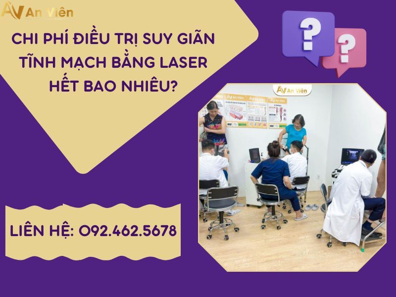 điều trị giãn tĩnh mạch chân