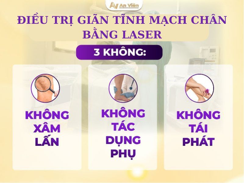 điều trị giãn tĩnh mạch chân