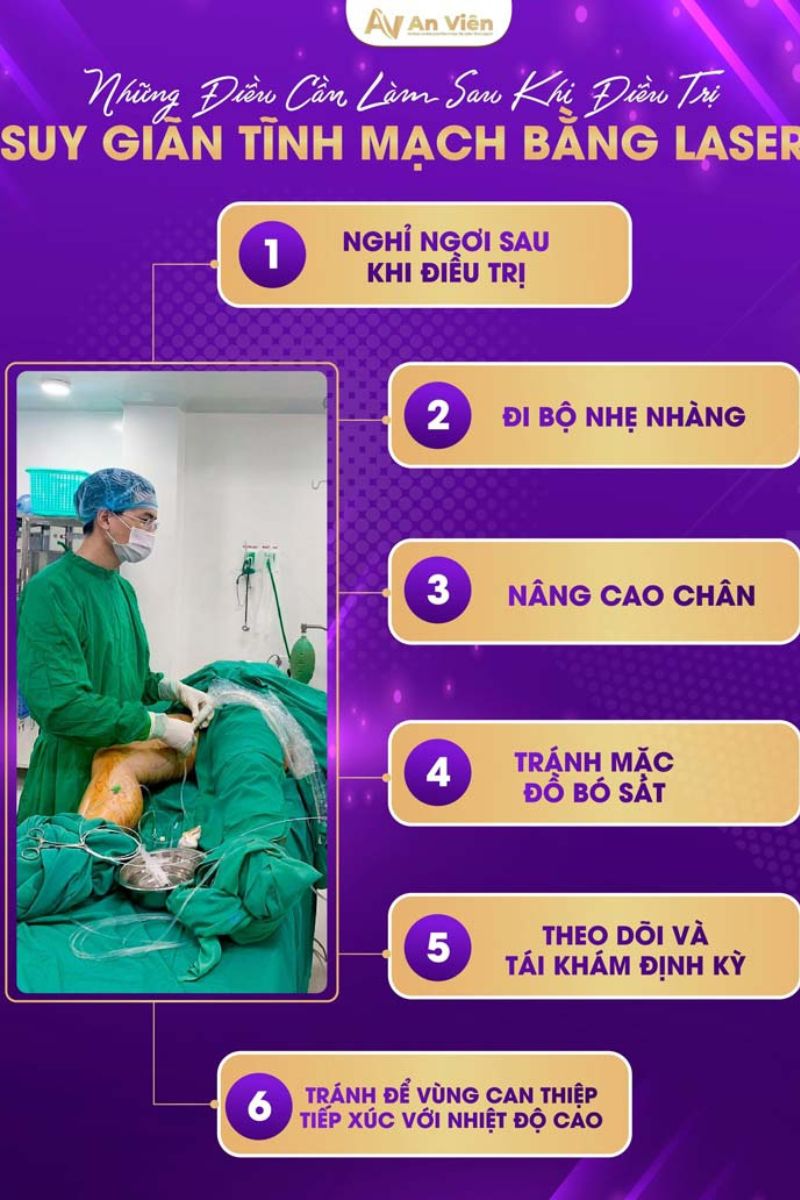 điều trị giãn tĩnh mạch chân