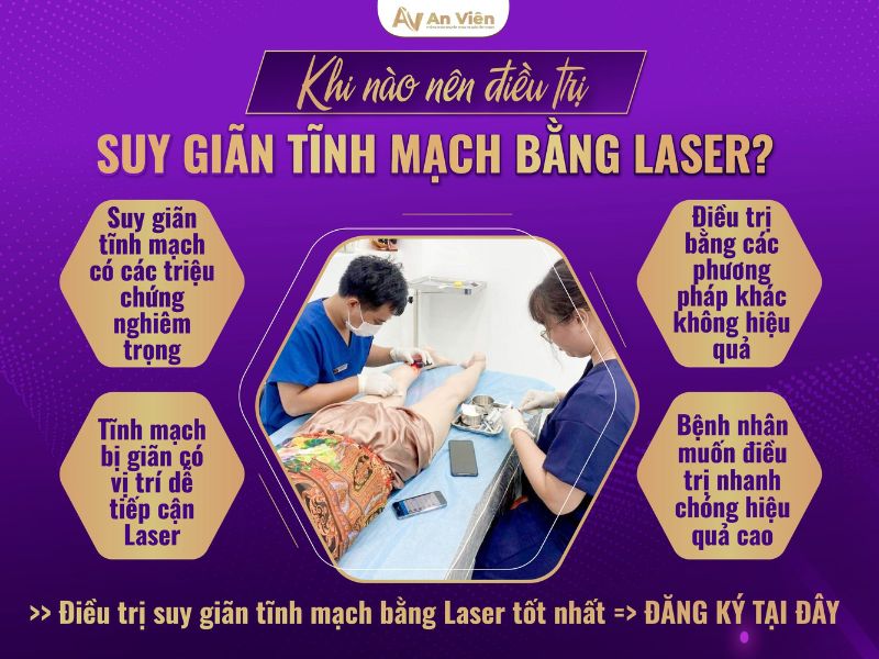 điều trị giãn tĩnh mạch chân