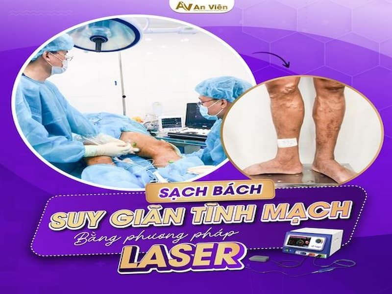 điều trị tĩnh mạch ở chân