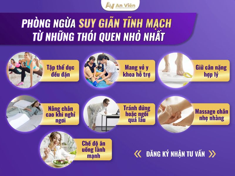 giãn tĩnh mạch chi dưới