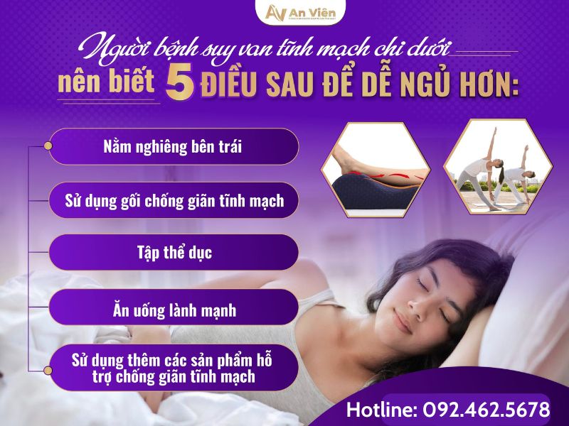 giãn tĩnh mạch ở chân