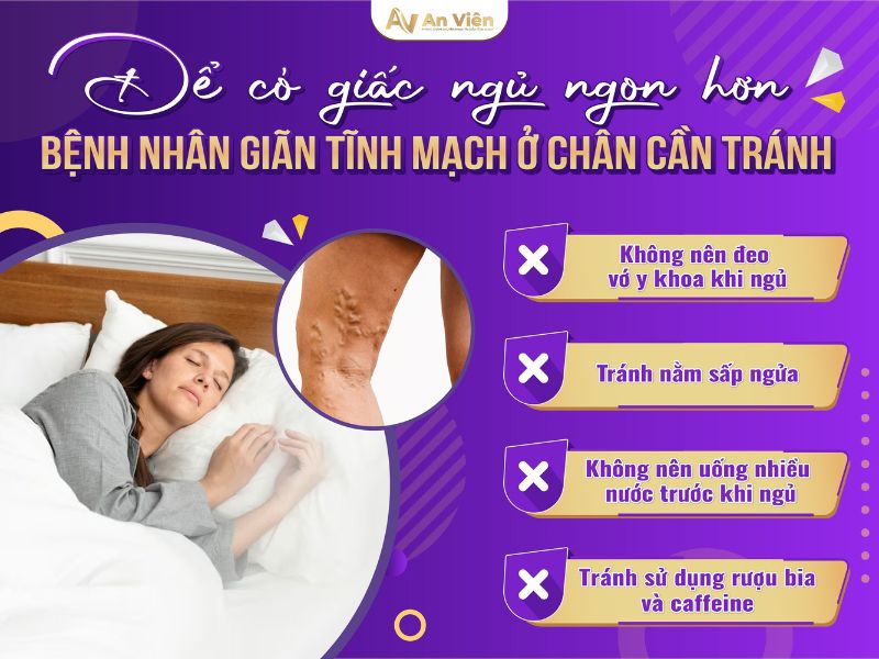 giãn tĩnh mạch ở chân