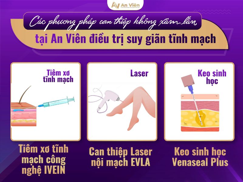 hiện tượng giãn tĩnh mạch chân