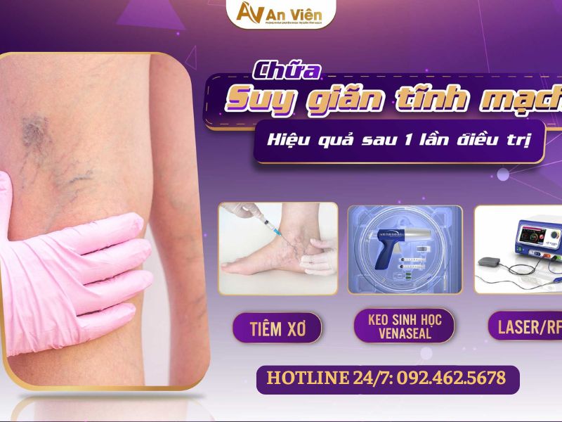 hiện tượng giãn tĩnh mạch chân