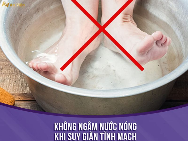 ngâm chân trị suy giãn tĩnh mạch