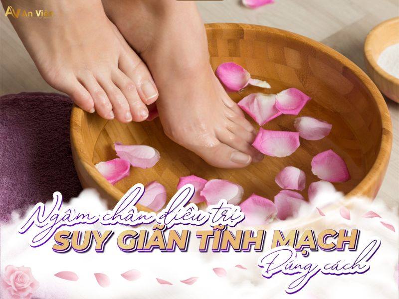ngâm chân trị suy giãn tĩnh mạch