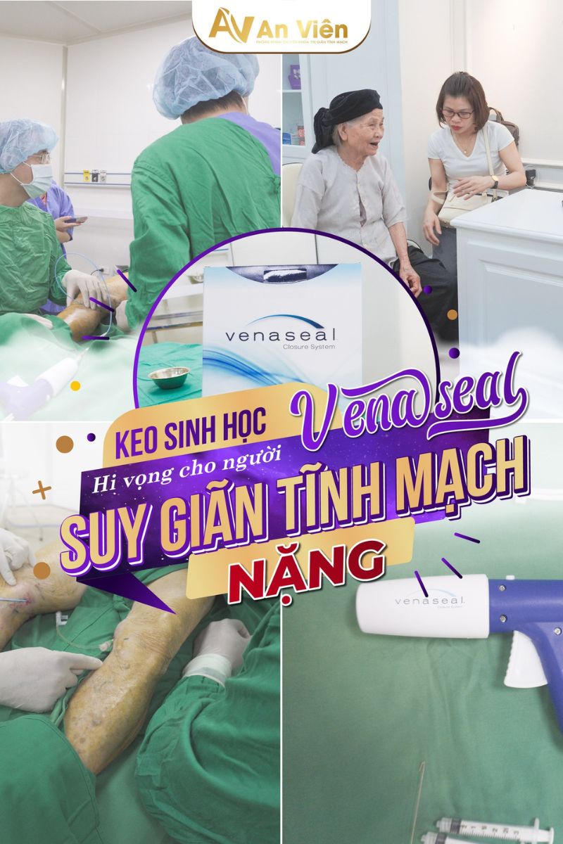 Phòng khám tĩnh mạch