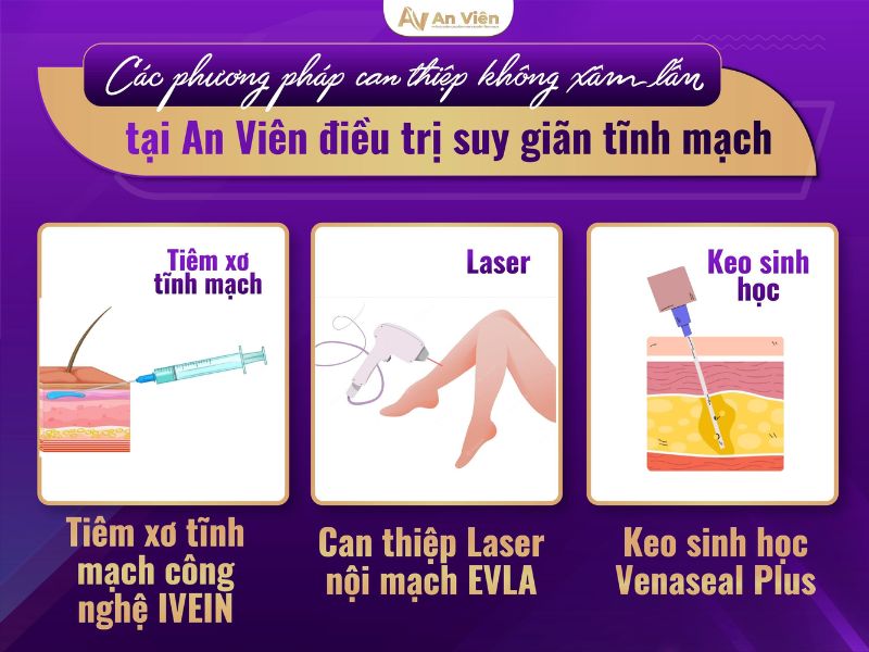 suy tĩnh mạch chân
