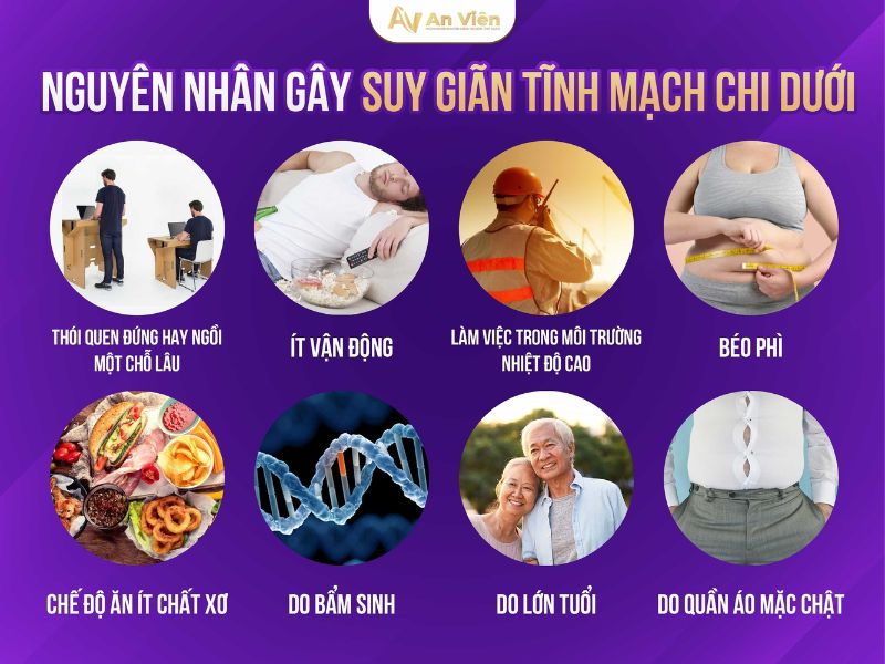 suy tĩnh mạch chân