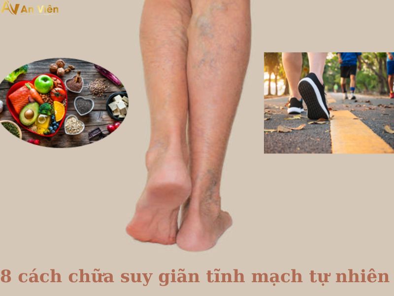 suy van tĩnh mạch chi dưới