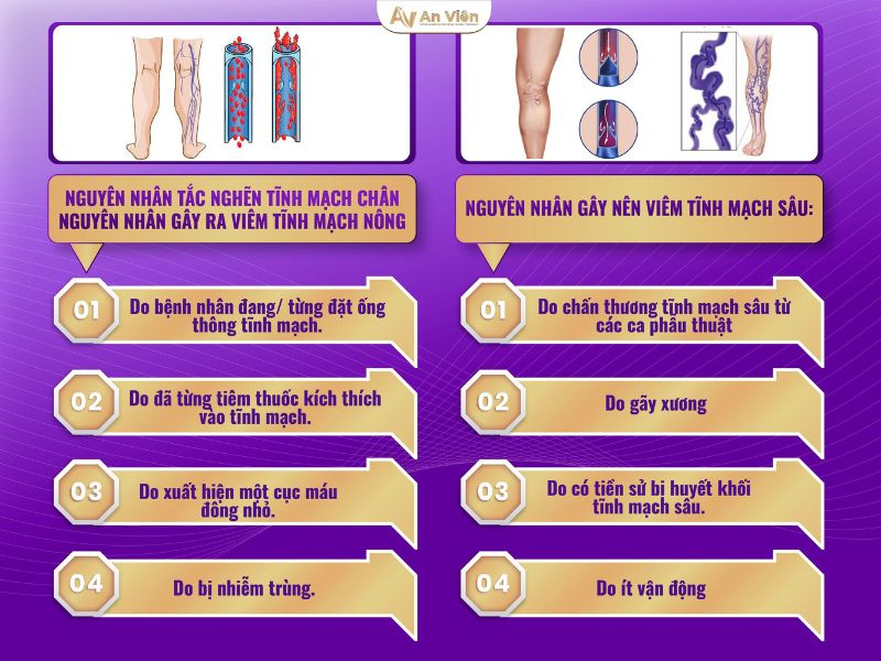 tắc nghẽn tĩnh mạch chân